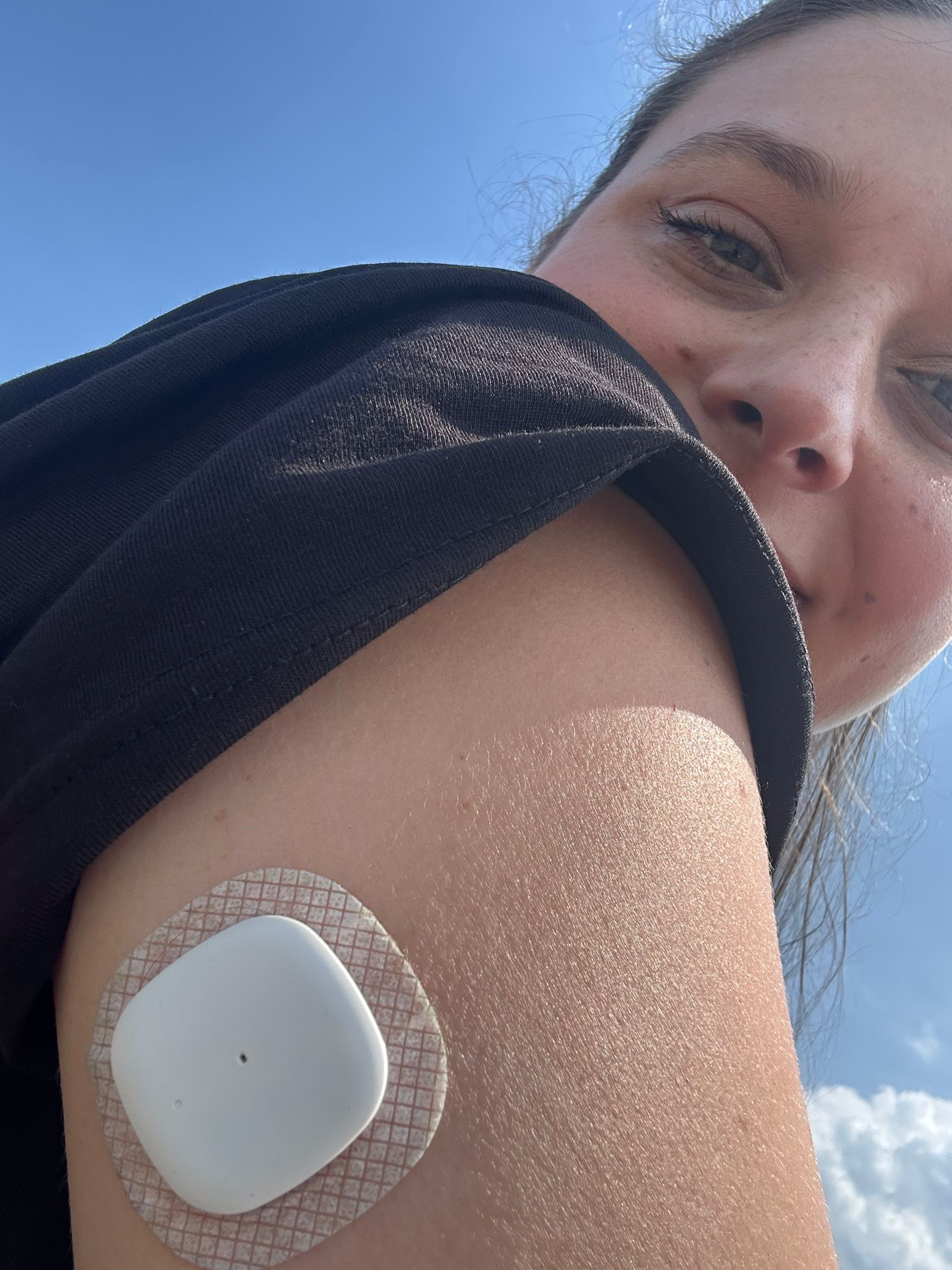 Factori externi ce pot influența citirile senzorilor de glicemie